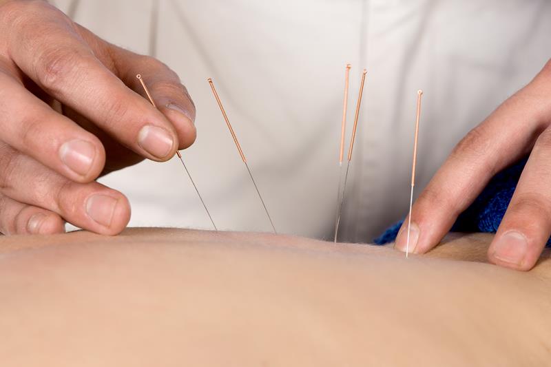 Acupuncture Greenbrier, AR 